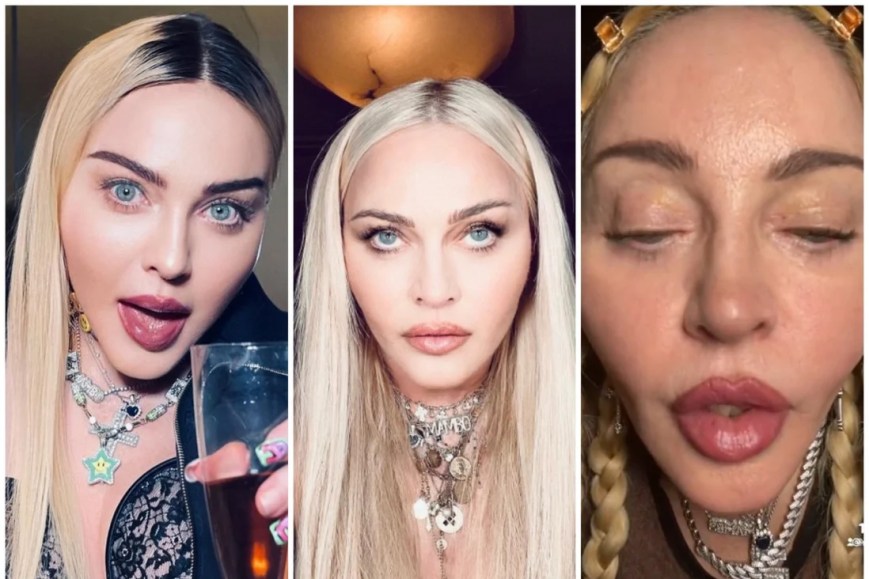 When Will People Stop Discussing Madonna’s “plastic surgery”?